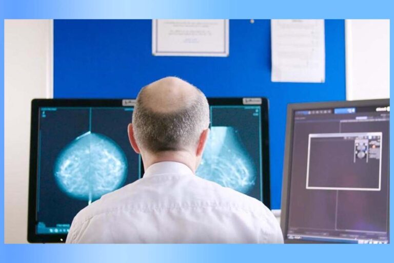 MIA: Breast Cancer Screening Tool Using AI